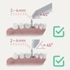 Kép 3/3 - NeoTell - Rezonanciafrekvenciás implantátum stabilitásmérő
