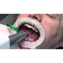 OptraGate Scanning regular 1db