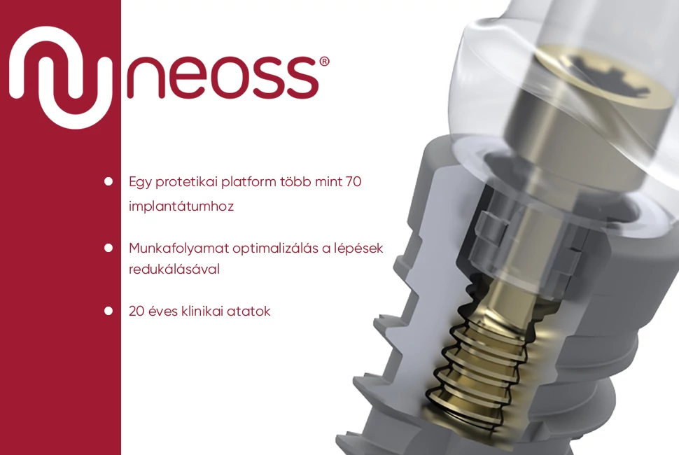 neoss általános